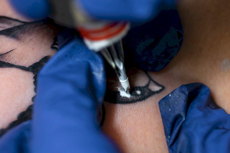 5 Best Tattoo Removal Companies in the United States