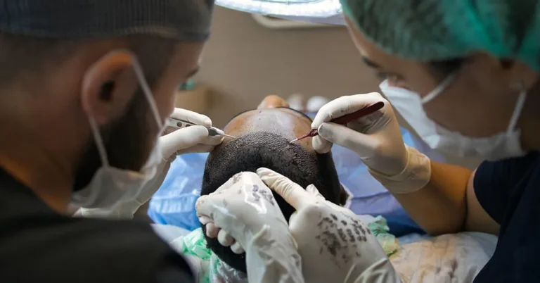 Hair Transplant Techniques in 2026: Costs, Success Rates & Best Options in the UK